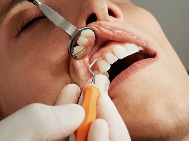 Zapalenie okostnej zęba - objawy i leczenie